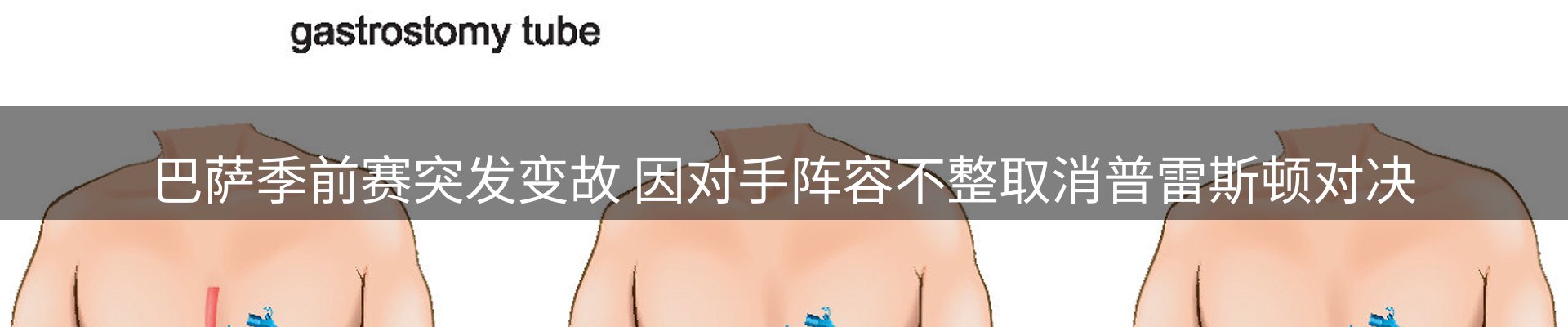 赛事资讯